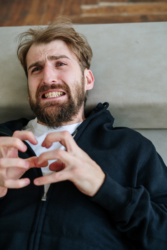 How to treat beard dandruff